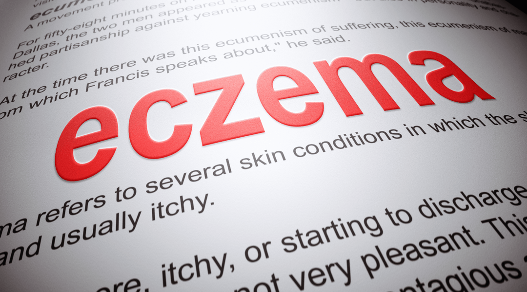 Can I Use Shea Butter as a Natural Eczema Balm?