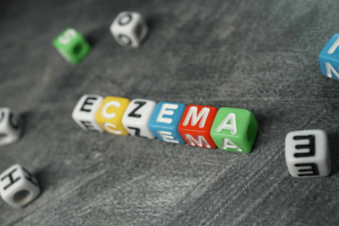 Beyond Steroids: A Natural Alternative for Eczema & Topical Steroid Withdrawal