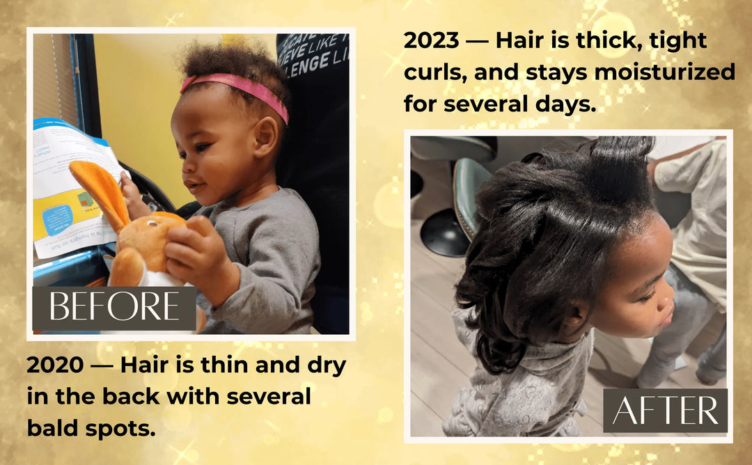 Itch-Away Hair Moisturizing Serum